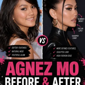 Agnez Mo Plastic Surgery Before and After