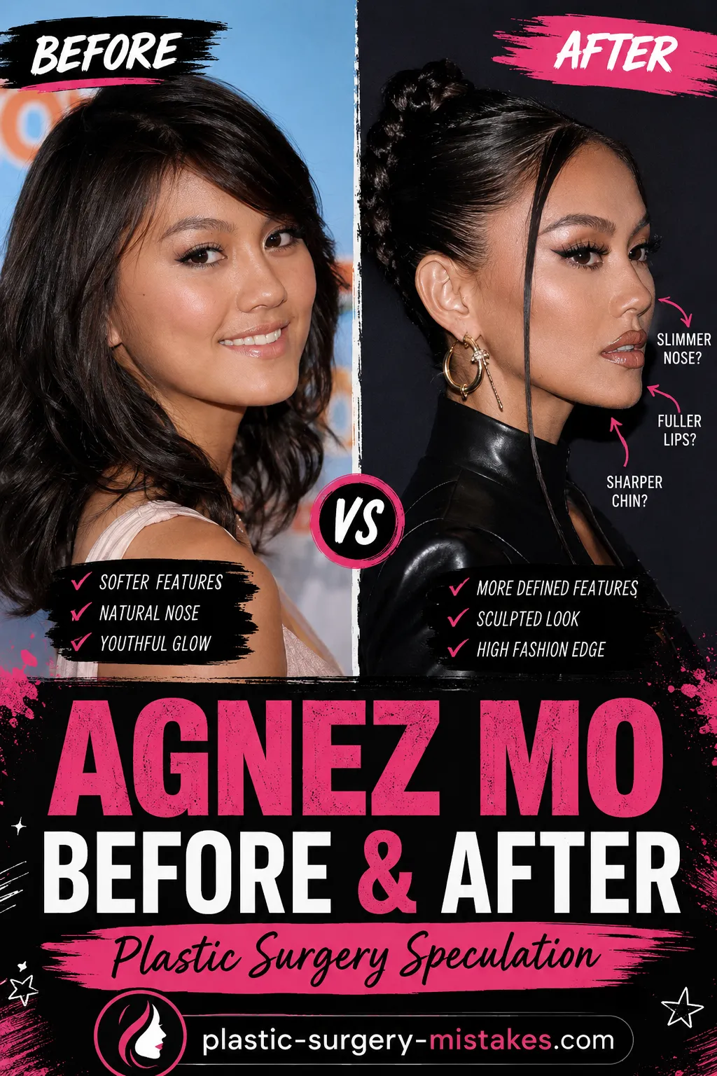 Agnez Mo Plastic Surgery Before and After Agnez Mo Plastic Surgery Before And After