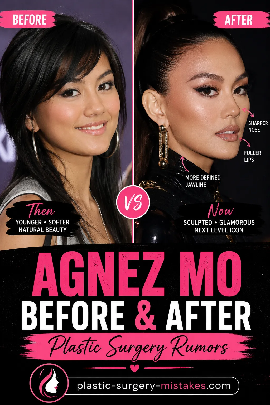 Agnez Mo Plastic Surgery Transformation Agnez Mo Plastic Surgery Transformation