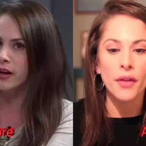 Ana Kasparian Before And After Nose Job