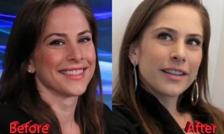Ana Kasparian Nose Job: What She Admitted—and What’s Still Rumor