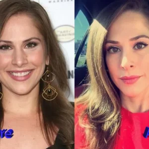 Ana Kasparian Plastic Surgery Before And After