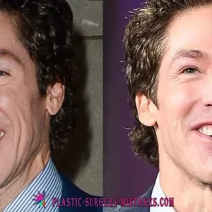 Joel Oesteen Transformation 2017-2026