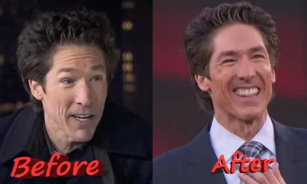 Joel Osteen Plastic Surgery: What Really Changed His Face?