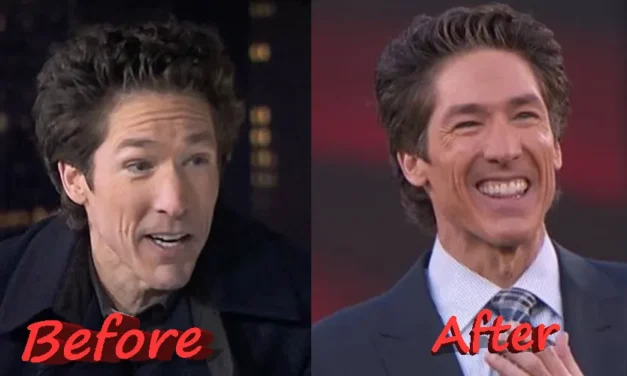 Joel Osteen Plastic Surgery: What Really Changed His Face?