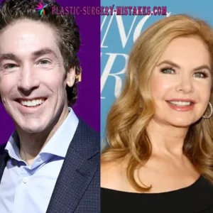 Joel and Victorija Oesteen Before and After Plastic Surgeries