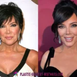 Kris Jenner Plastic Surgery: Two Facelifts, a Viral New Face & the 2026 Rumor She Shut Down