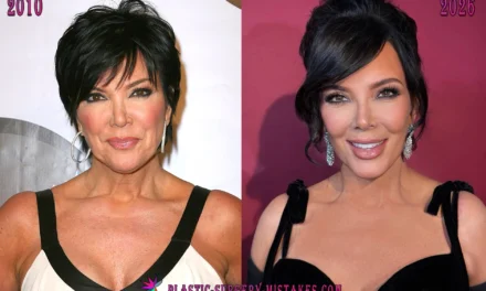 Kris Jenner Plastic Surgery: Two Facelifts, a Viral New Face & the 2026 Rumor She Shut Down